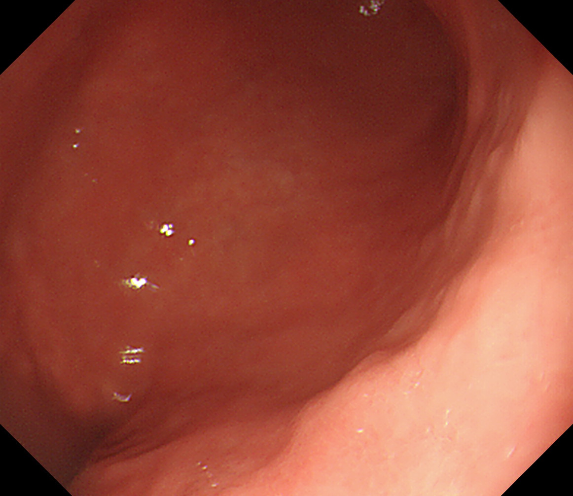 �����H��